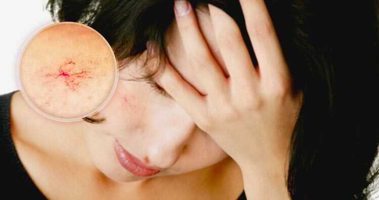 5 Hậu quả của việc không sử dụng kem chống nắng