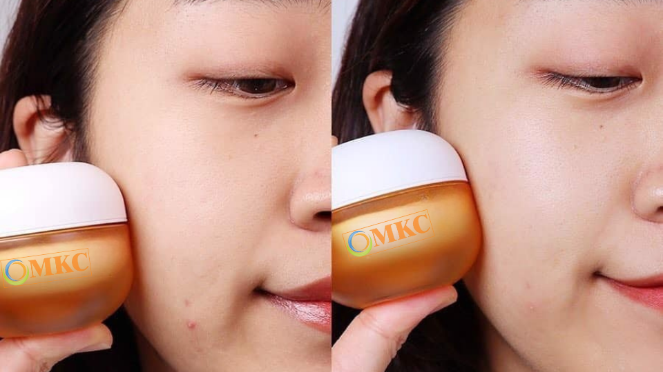 Da sáng đều màu sau 3 tuần nhờ serum MK Cosmetics!